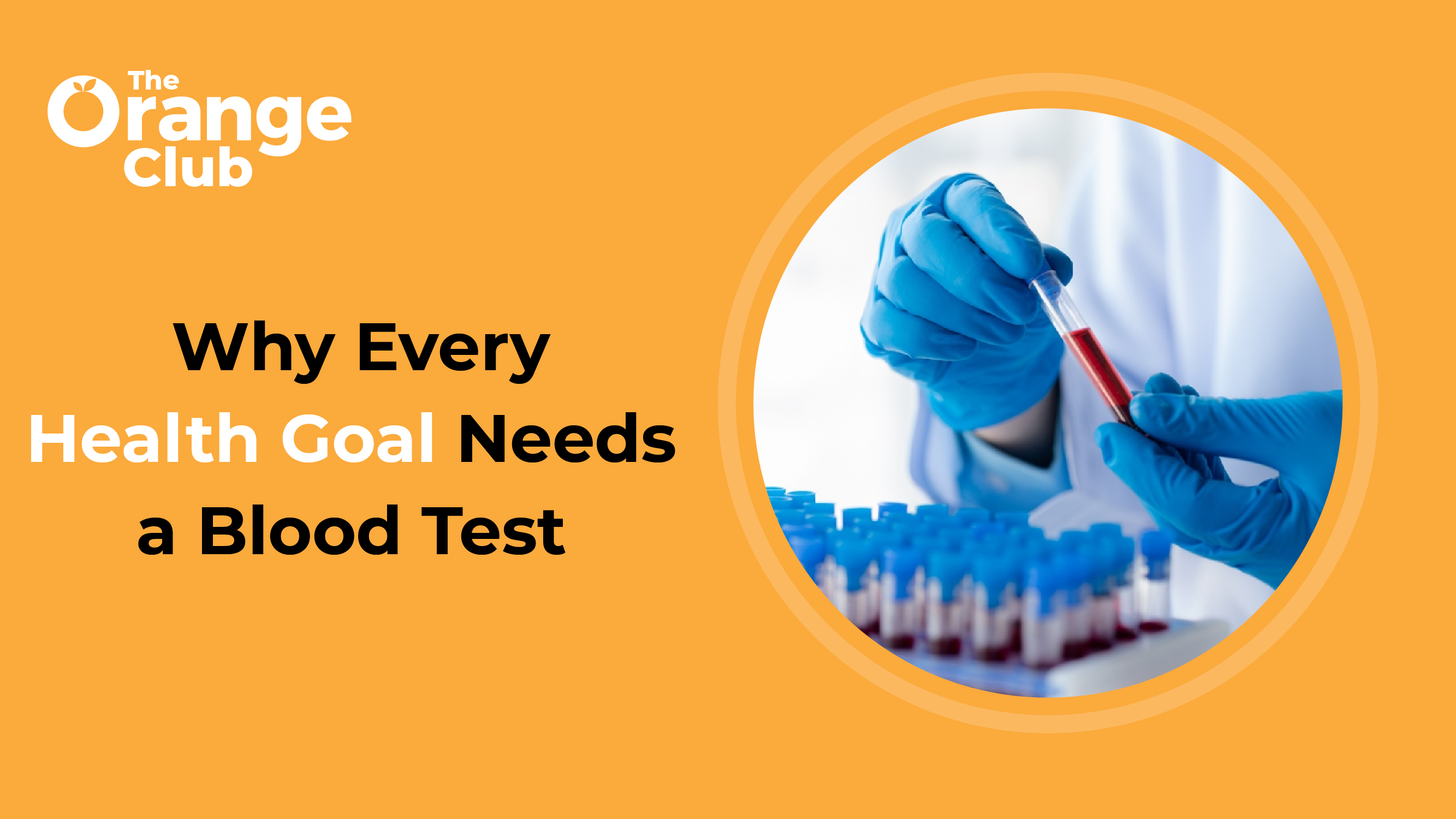 Why You Should Start Your Health Journey With a Blood Test?